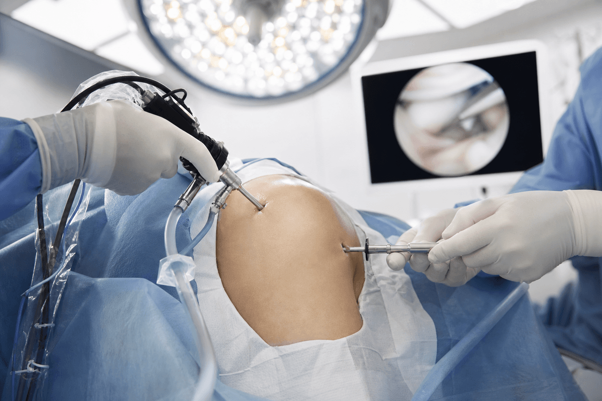 Arthroscopic Surgeries - Shoulder