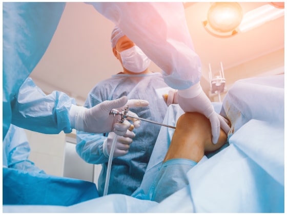 arthroscopic-surgeries-knee